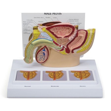 GPI ANATOMICAL Anatomical Model - Male Pelvis - Prostate - 3D Frame 3551